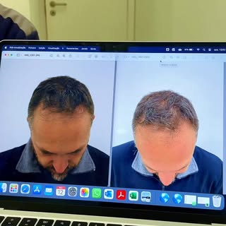HairScience — onde a ciência encontra resultados reais. 🔬✨

Este antes e depois mostra o que é poss