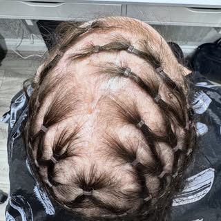 New year, new hair, new beginnings 🤍
Your journey to better hair and renewed confidence starts here