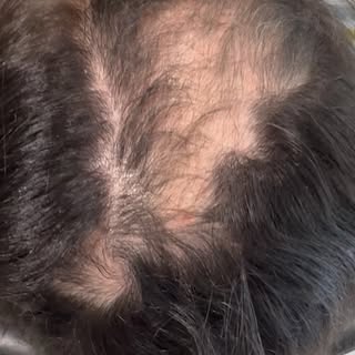 Some transformations are about so much more than hair 🫶🏼.

A lovely lady came to me carrying a sec