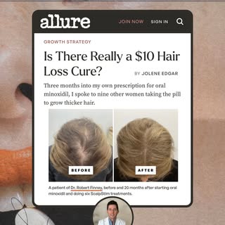 Oral minoxidil has earned the hype. 👀

Thanks to @joleneewrites and @allure for including me in thi