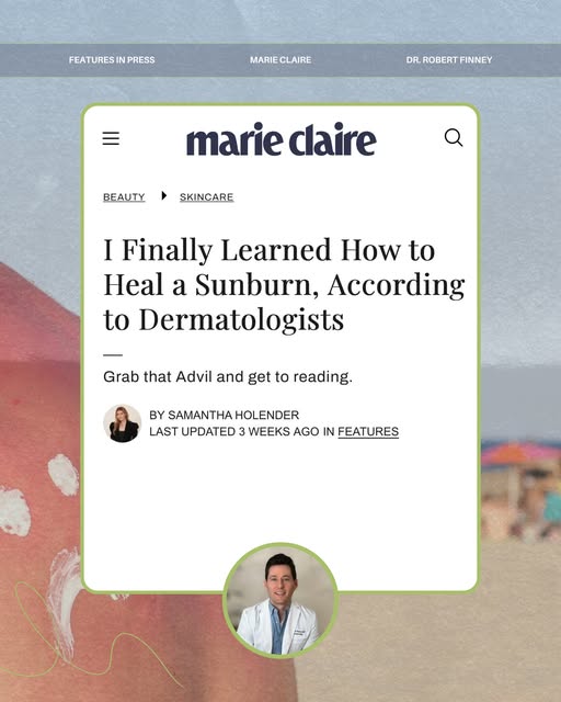 Even the best sunscreen routine isn’t completely sunburn-proof. ☀️🔥

Take it from your pasty Irish 