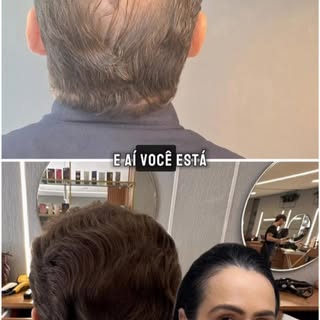 É possível ter resultados naturais com o tratamento clínico e sem precisar recorrer ao transplante c