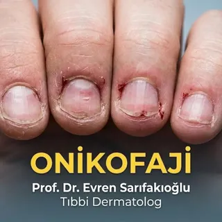 Hafif Görülen Bir Alışkanlık, Derin Hasar

Bazen sadece bir stres anında, bazen de çocukluktan gelen