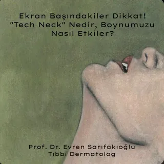 Ekran Başındakiler Dikkat! "Tech Neck" Nedir, Boynumuzu Nasıl Etkiler?

Gün içinde başınızı kaç kez 