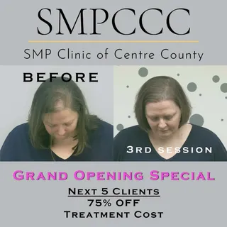 Amazing results after only 3 of the 4 sessions. To celebrate her transformation, I'm booking the nex