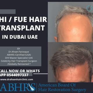 ✨ Transforming confidence, one follicle at a time!

💡 Did you know? DHI (Direct Hair Implantation) 