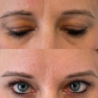 “Botox effect”: cancella la stanchezza meglio di una vacanza 🏝️🌊✨😉