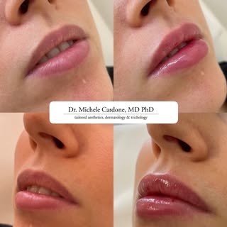 🌟 Scopri Hydralips 🌟

✨ Questo non è un filler! ✨

Hai sempre desiderato labbra idratate e natural