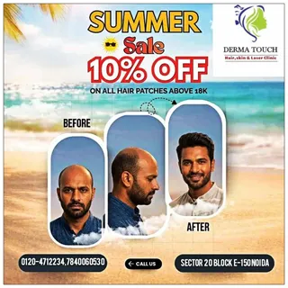 Summer 🏝️ season special  sale!! 
On hair replacement system buy 1 patch  Rs 7'999/- get  2  hair p