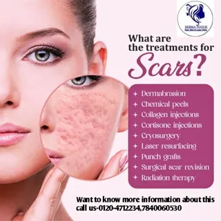 Acne free Scare free skin start here Derma Touch Hair,Skin &Laser Aesthetic Clinic flate 30% off cal