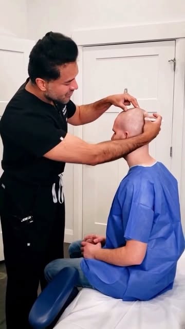 Top ups. What Are They And When Do You Need Them?
 
Hair transplants are sometimes limited in how de