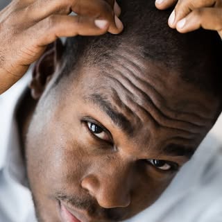 Men, going bald isn’t the only option. 👀
Fix it before it fixes you.
Visit HAIRMD.com today! 

#men