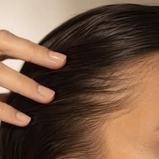 From 17 to 82… hair restoration has no age limit 👀

#hairegrowth #hairtransplant #hairtransplantcli