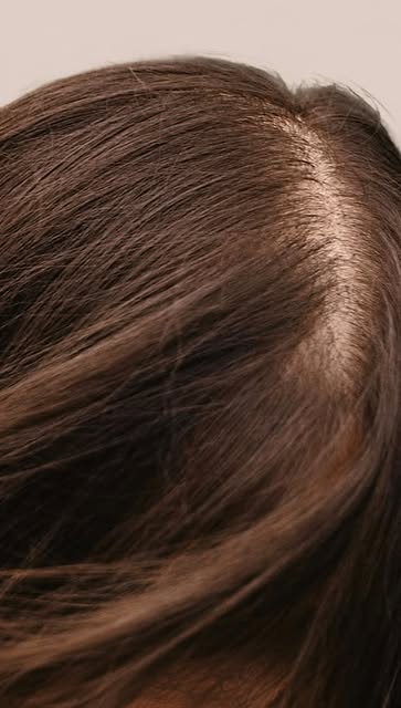 A hairline comeback, but make it surgical. 👏 

#hairtransplant #hairtransplantclinic #menshairloss 