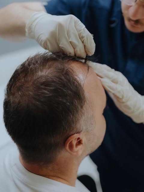 It’s more than just getting hair back. 👀 From consultation to graft placement to recovery, every st