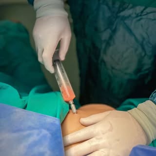 At MD Brothers, we offer advanced stem cell therapy designed to support your body’s natural healing 