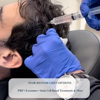Hair restoration, tailored to you. ✨At MD Brothers, you have options! We offer personalized hair res