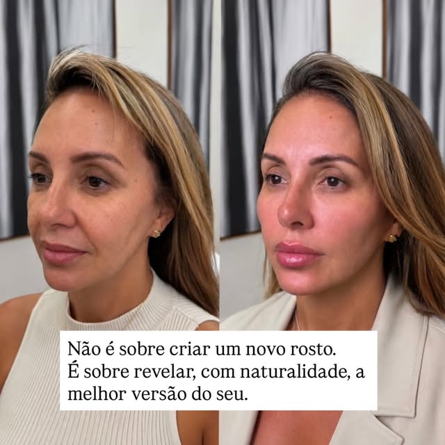 Não é sobre criar um novo rosto.
É sobre revelar, com naturalidade, a melhor versão do seu.