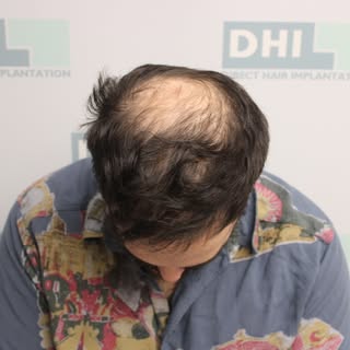 רק לפני 6 חודשים עדי ביקר אצלנו 
רק 6 חודשים בשביל שהוא יגיד "אני לא מזהה את עצמי במראה וזה הכי כיף 