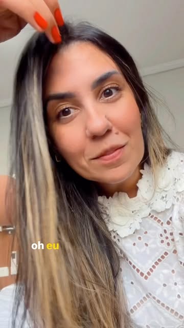 Cabelo branco é normal com o passar dos anos. 

Mas, quando surge precocemente ou aumenta de forma r