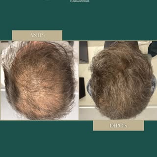✨ 7 meses que mudaram não só o cabelo… mas a confiança no espelho. E o resultado final só vem após 1