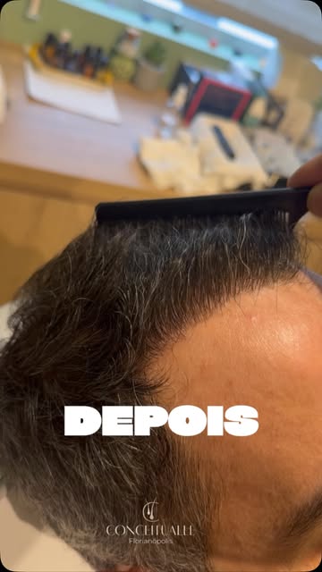6 MESES DE EVOLUÇÃO. 🚀🧑🏻‍⚕️

O resultado começa a aparecer — e essa transformação mostra como o t