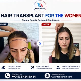 #HairTransplant #hairtransplantantalya #sacekimantalya #haartransplantation #haartransplantantalya