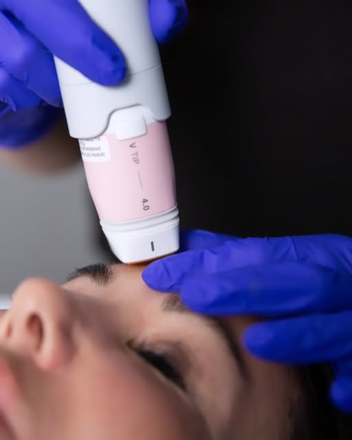 Looking for a way to improve skin firmness without needles, surgery, or downtime?

Everesse RF at Fi