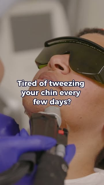 Tired of constantly tweezing, shaving, or checking for those unwanted chin hairs?

Laser hair reduct