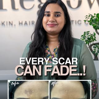 From scars to smooth skin — science can rewrite your story. 

Every scar has a story, but it doesn’t
