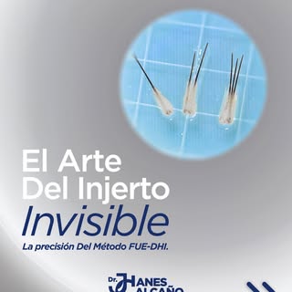 El arte de un trasplante exitoso está en los detalles. 🙌🏻🙌🏻

Con la técnica FUE-DHI, implantamos