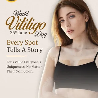 True beauty is being comfortable in your own skin. Happy World Vitiligo Day! 🕊️✨

Every mark is a b