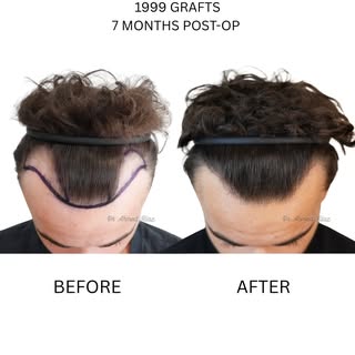 Real patients. Real results.

Documented with high-quality photography.

This was a slightly more ch