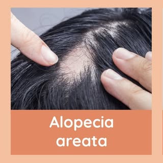 A common arthritis drug is showing impressive hair-regrowth results.

New Phase 3 research on the JA