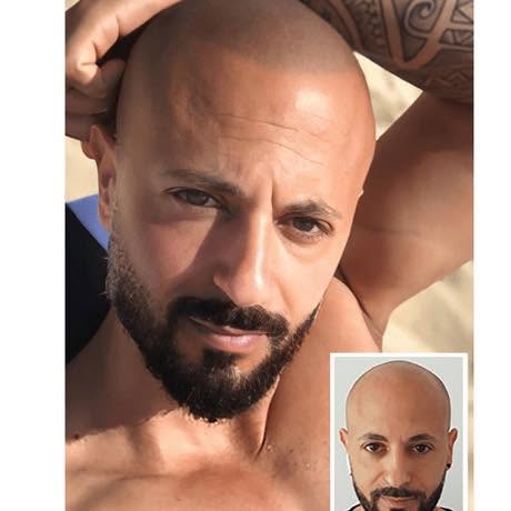 Good news! Studies have found that men with shaved heads may be perceived as more masculine, confide