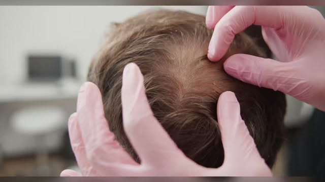 If thinning hair bothers you, we can help 👉DelawareHairRestoration.com