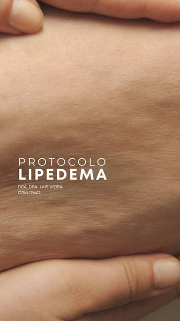 Lipedema não é apenas gordura.

É uma doença crônica que pode causar dor, peso nas pernas, hematomas