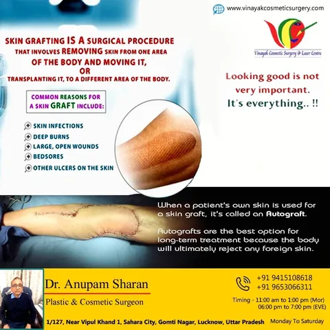 Skin grafting is a surgical procedure where healthy skin is transplanted to replace damaged or lost 