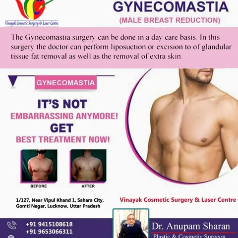 Gynecomastia surgery, or male breast reduction, aims to #reduce excess breast tissue in men. It's ty