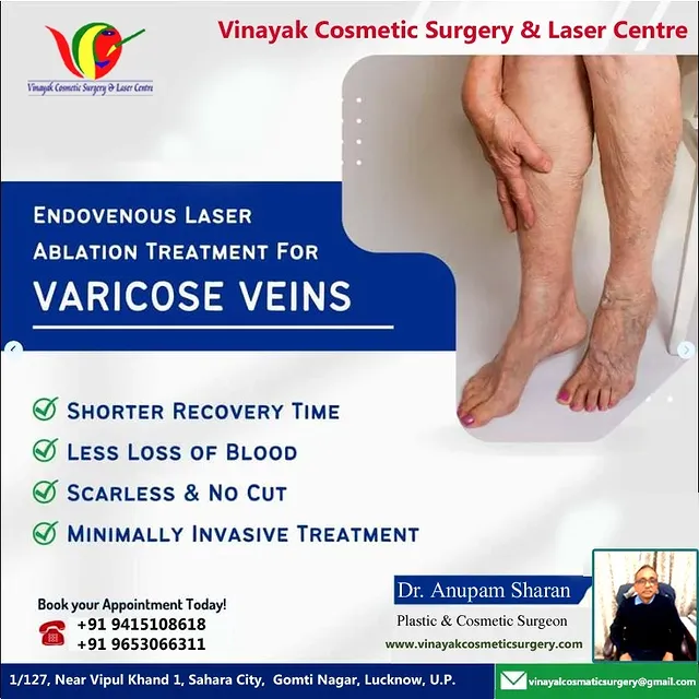 Endovenous laser ablation treats varicose veins by directing laser energy to seal affected veins, pr
