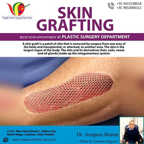 Skin grafting is a surgical procedure where skin is transplanted to cover a wound. It's often used t