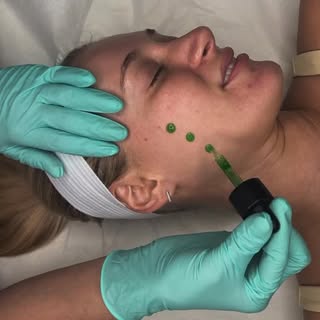 Check this out 👀

Microneedling is the perfect treatment to continue reaching your skin goals this 