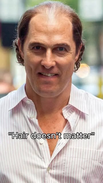 "Hair doesn't matter..." Tell that to Matthew McConaughey 🎬✨

Watch how a restored hairline complet