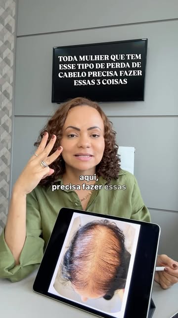 A alopecia androgenética não acontece por um único motivo — e é justamente por isso que, muitas veze