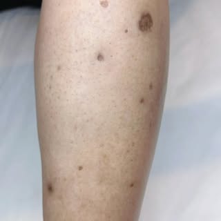 “BREATHE”, Skin Illusions has solutions for YOU!

🌟✨ Celebrating this incredible transformation! ✨�