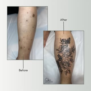Transformation complete! 
SKIN ILLUSIONS, makes it easy to go from self-conscious to confident! 

Wh