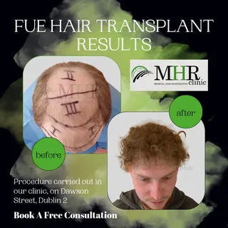 From thinning to transformation 💥
This before & after result shows what can be achieved with a care
