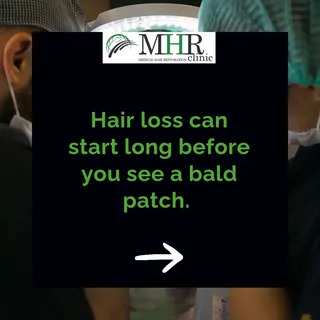 Hair loss can start long before you see a bald patch 👀

Some of the earliest signs are easy to miss