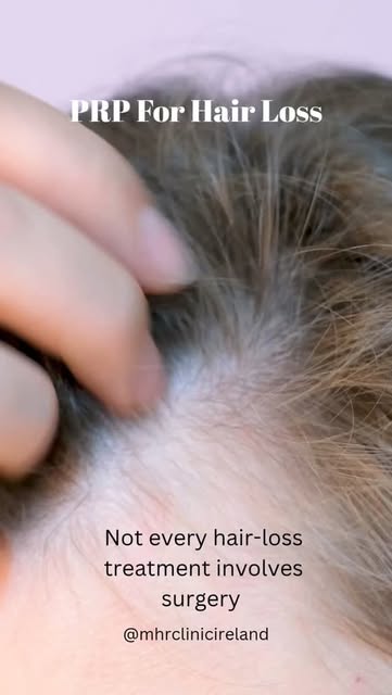 Not every hair-loss treatment involves surgery 👀

PRP + Mesotherapy combines platelet-rich plasma w
