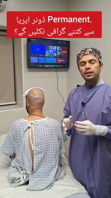 Hair Transplant by Dr Burhan Ashraf #foryou #viral #hairtransplant #drburhan #wbesthetique